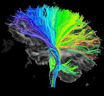 Memory – Smart Brain Solutions